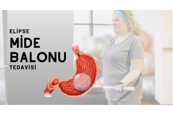 Yutulan Mide Balonu Fiyat