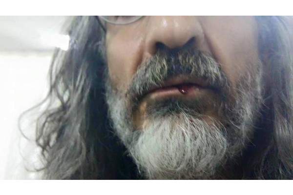 GAZETECİYE ÇİRKİN SALDIRI