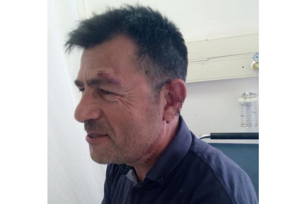 OKUL MÜDÜRÜNE ÇİRKİN SALDIRI