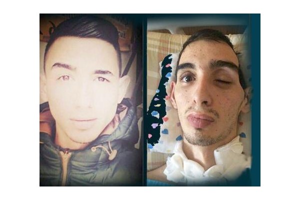 HASAN İÇİN UMUT IŞIĞI...